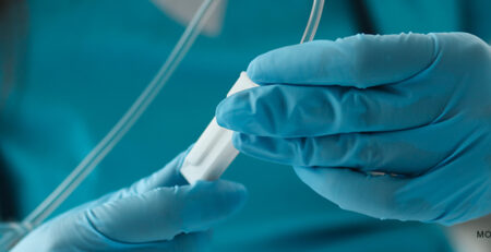 Understanding the Role of Aspiration Tubing in Surgeries